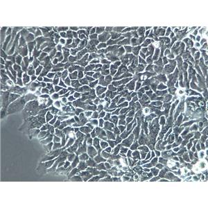 VK2/E6E7 Cells|人阴道上皮克隆细胞