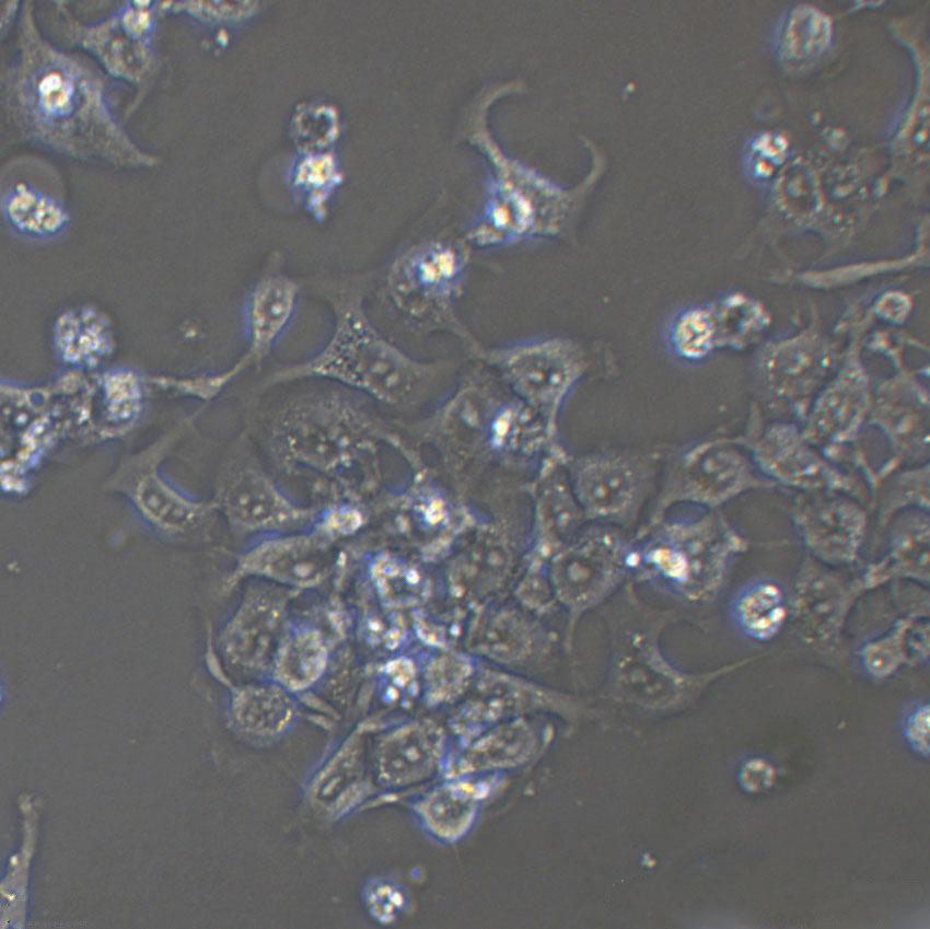 KU-19-19 Cells|人膀胱癌克隆细胞,KU-19-19 Cell