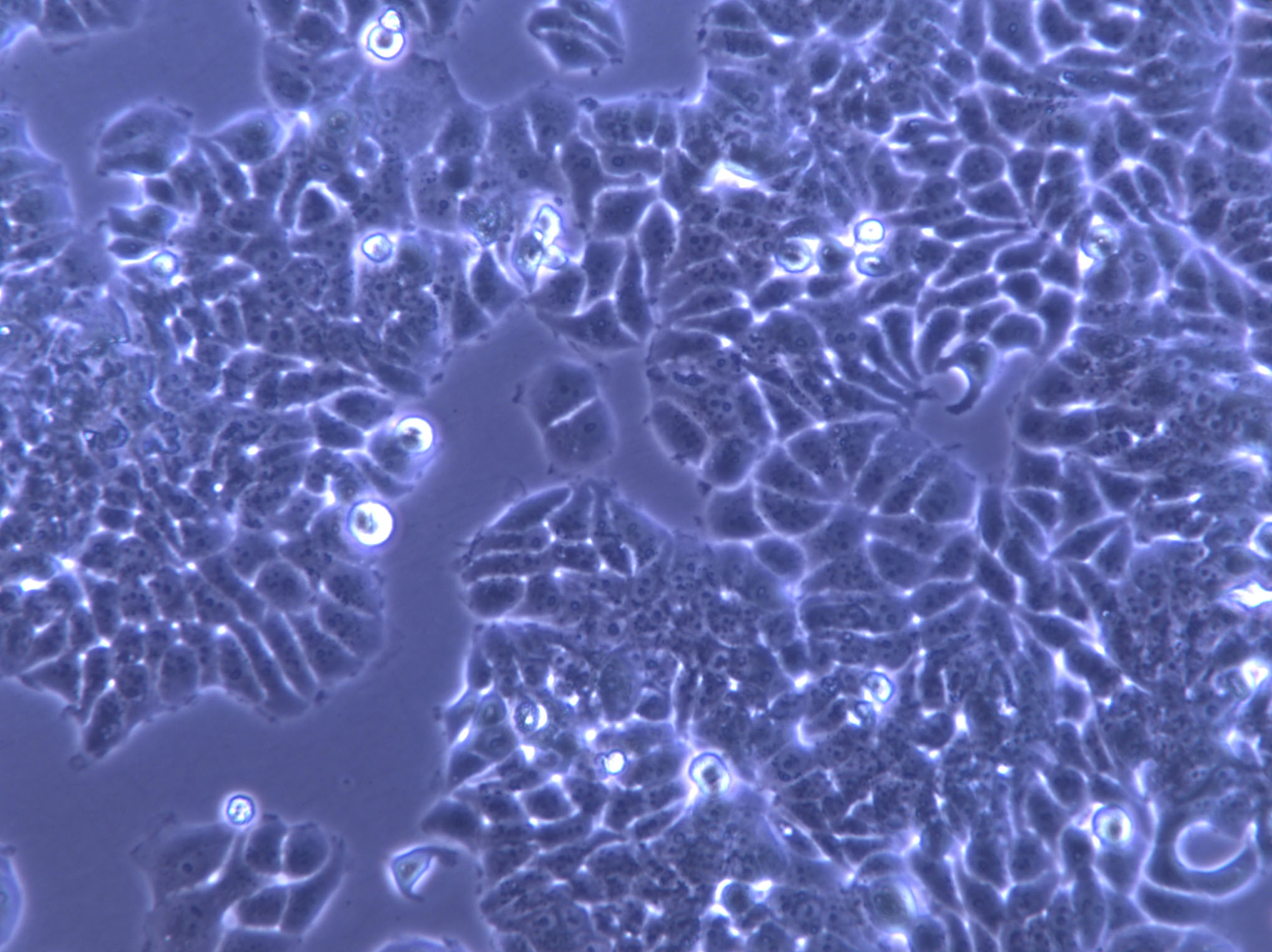 HuLEC-5a Cells|人肺微血管内皮克隆细胞,HuLEC-5a Cells