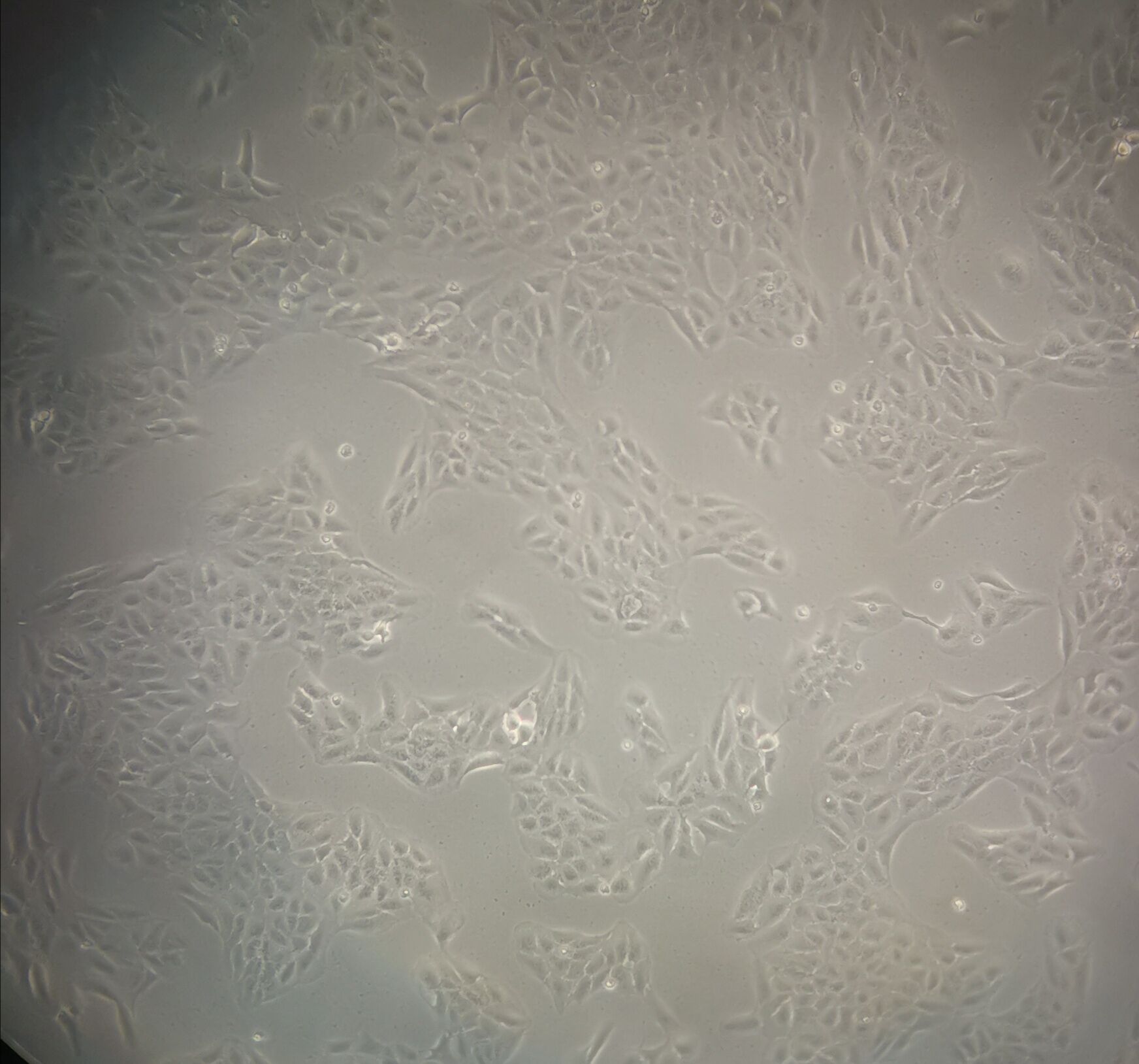 NCI-H125 Cells|人非小细胞肺癌克隆细胞,NCI-H125 Cells