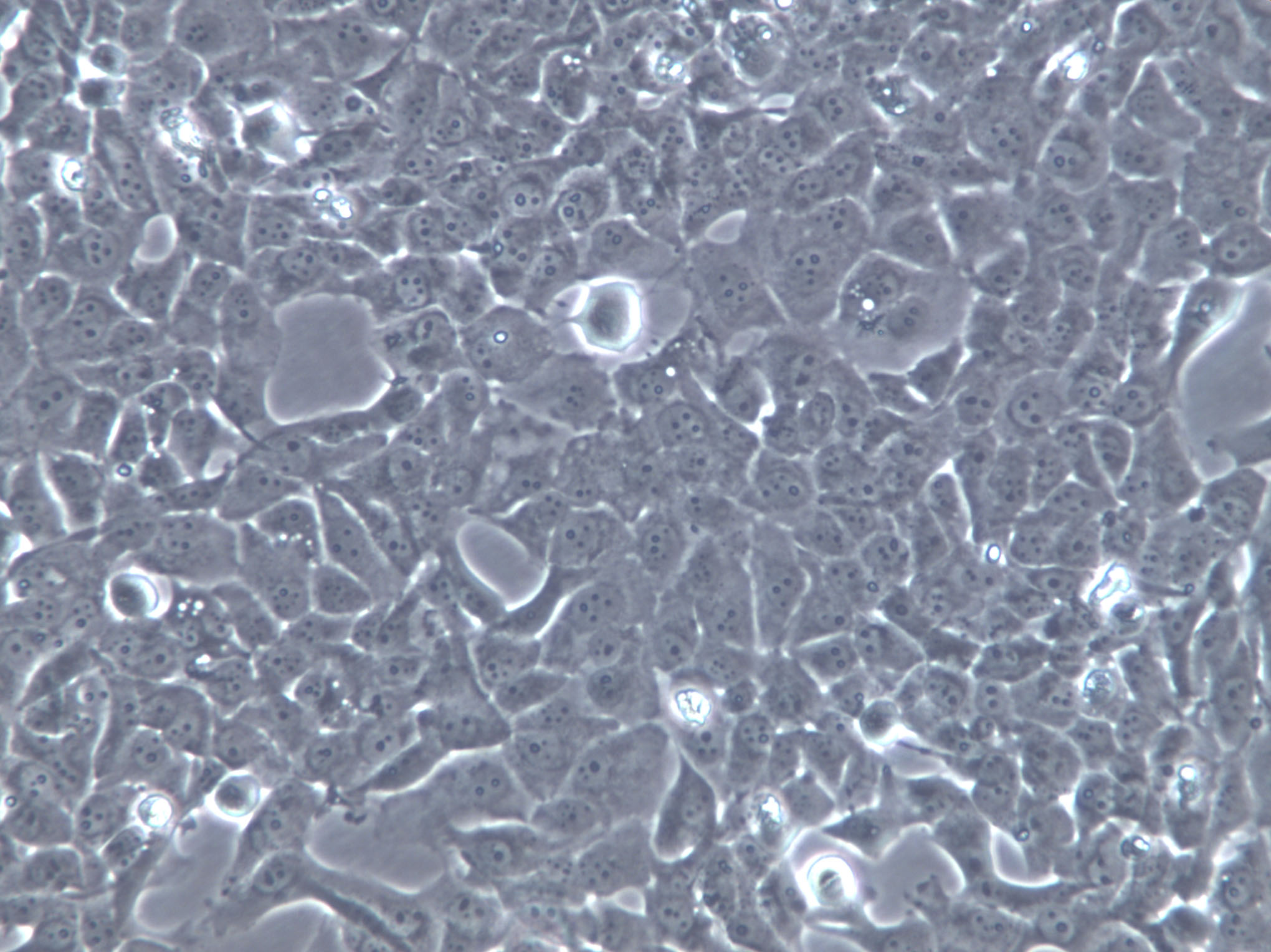 Hep-G2 Cells|人肝癌克隆细胞,Hep-G2 Cells