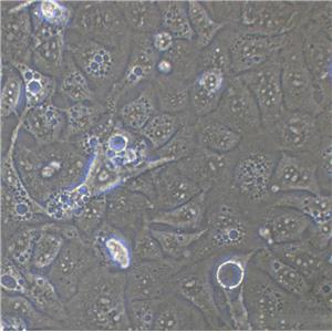 RIN-14B Cells|大鼠胰岛素瘤克隆细胞