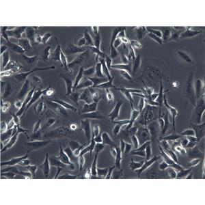 UM-RC-2 Cells|人肾透明细胞癌克隆细胞