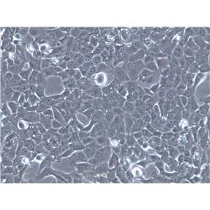Hep-G2 Cells|人肝癌克隆细胞