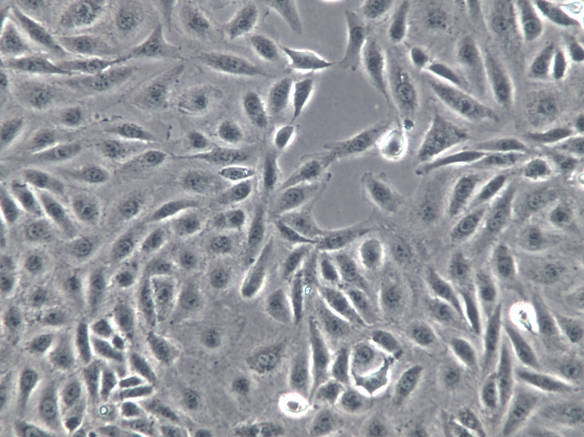 SCL-I Cells(赠送Str鉴定报告)|人皮肤磷癌细胞,SCL-I Cells