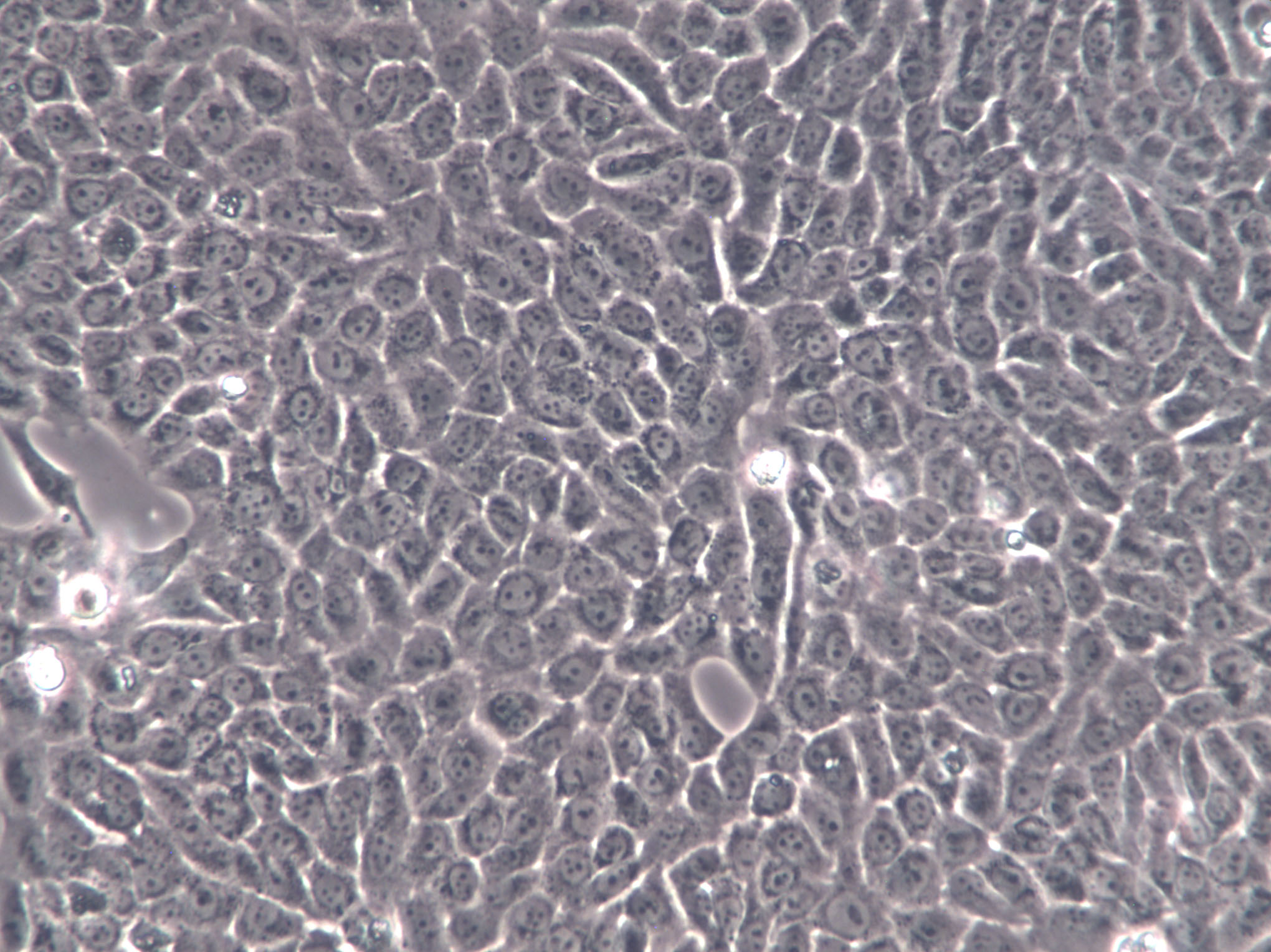 COLO 201 Cells(赠送Str鉴定报告)|人结直肠腺癌细胞,COLO 201 Cells
