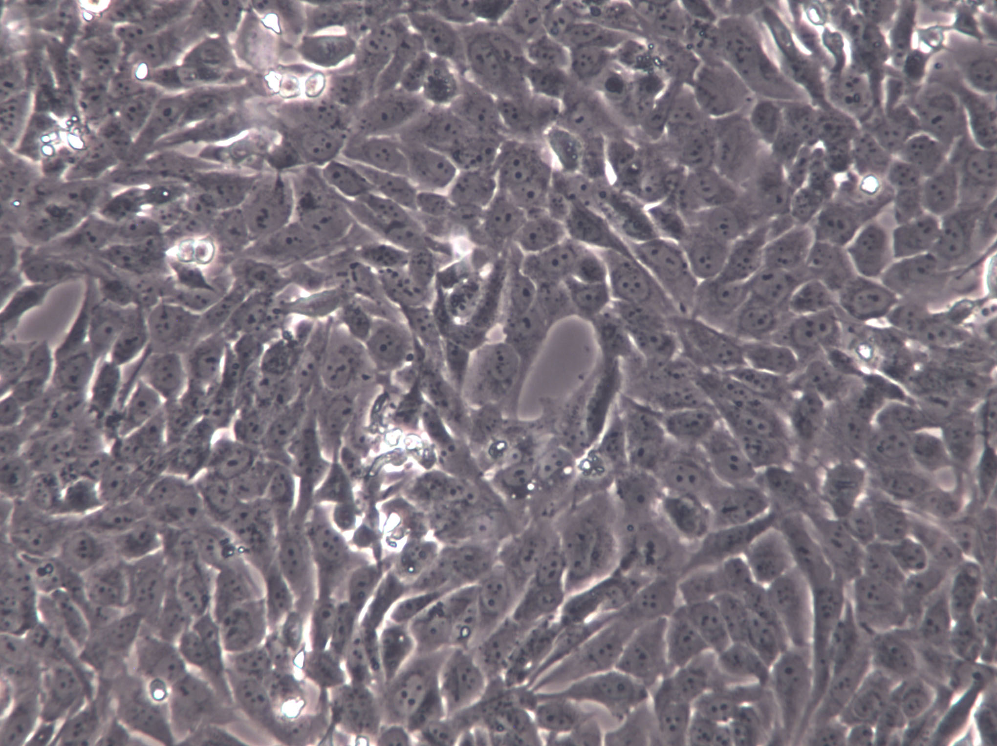 bEnd.3[BEND3] Cells|小鼠脑内皮瘤克隆细胞,bEnd.3[BEND3] Cells