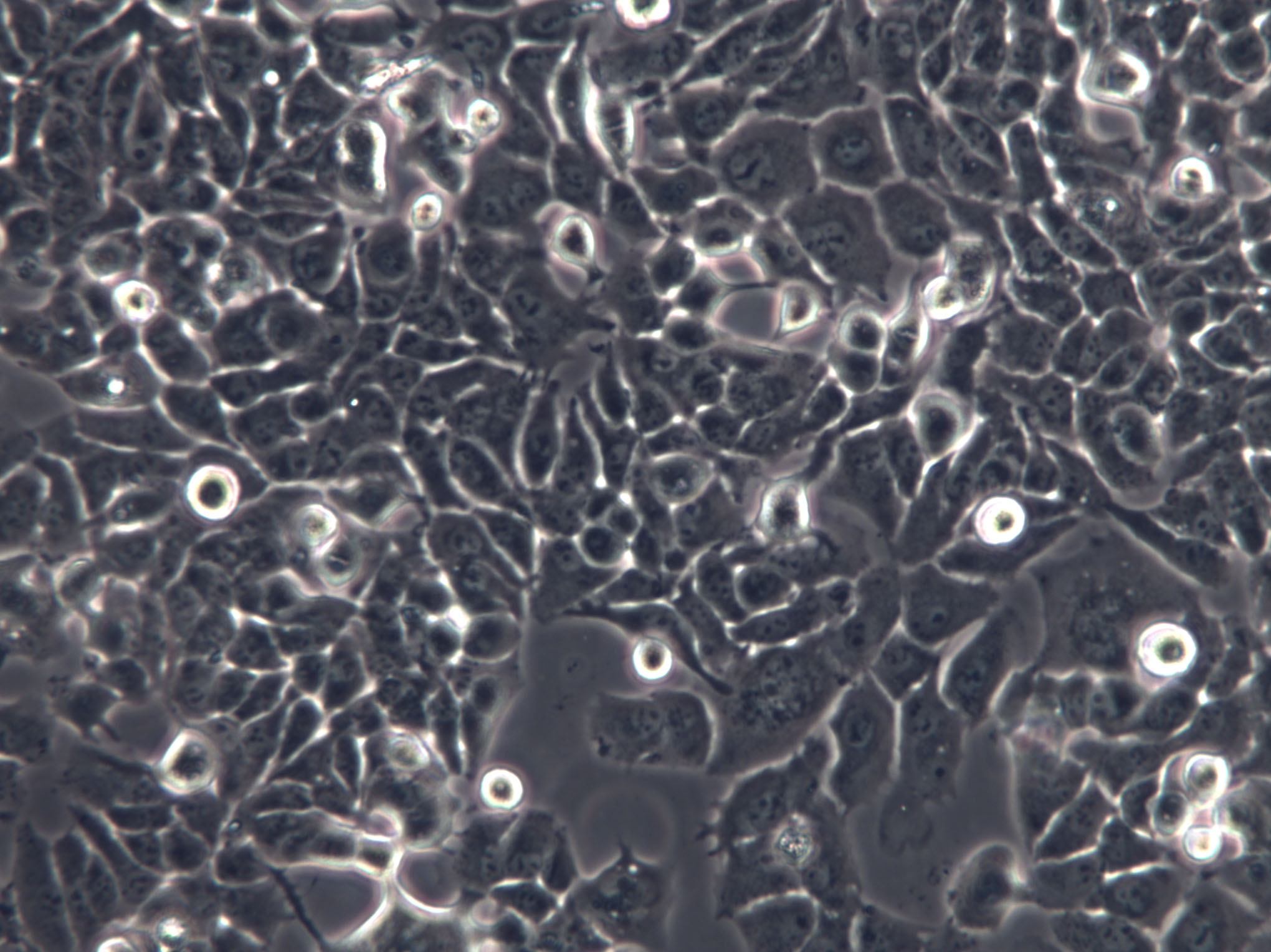 COLO 394 Cells|人结肠癌克隆细胞,COLO 394 Cells