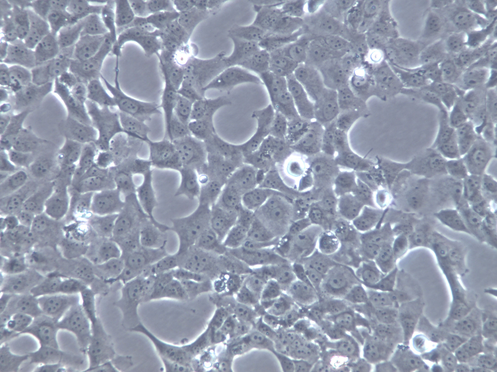 NCL-H548 Cells|人胰腺癌克隆细胞,NCL-H548 Cells