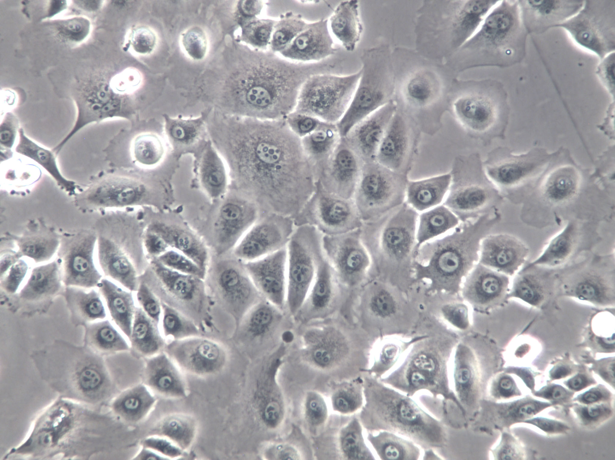 COLO 206F Cells|人結(jié)腸癌克隆細(xì)胞,COLO 206F Cells