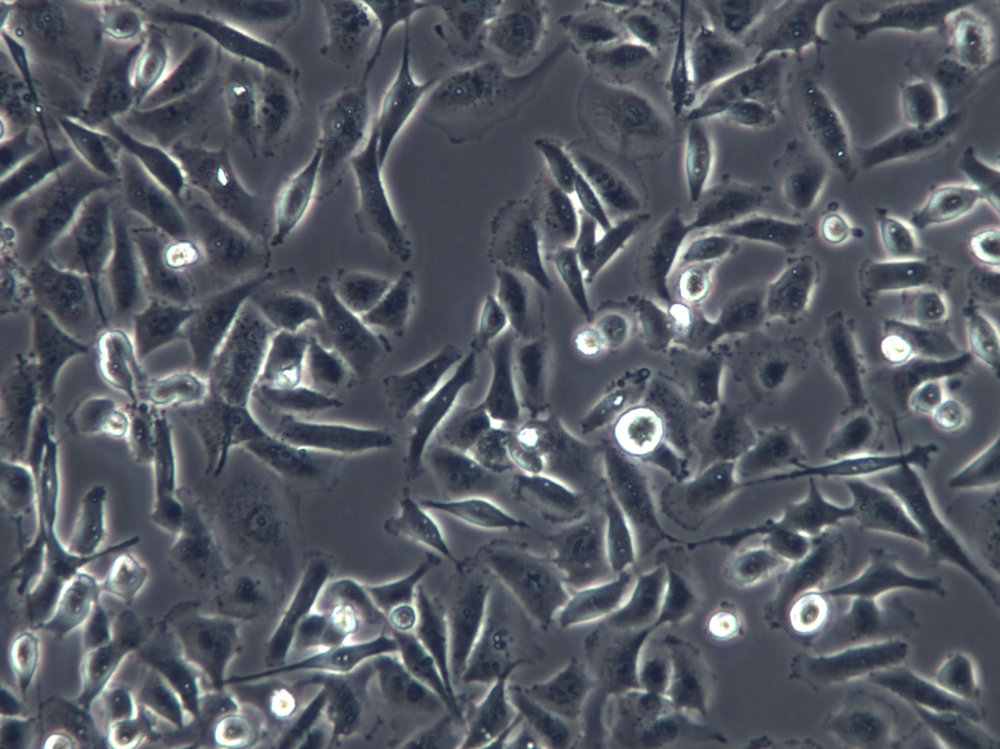 UWB1.289 Cells