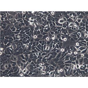 SK-OV-3 Cells(赠送Str鉴定报告)|人卵巢癌细胞,SK-OV-3 Cells