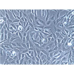 Li-7 Cells(赠送Str鉴定报告)|人肝癌细胞,Li-7 Cells