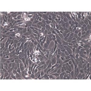 bEnd.3[BEND3] Cells|小鼠脑内皮瘤克隆细胞