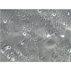 COLO 738 Cells|人胸腔积液恶性纤维组织克隆细胞