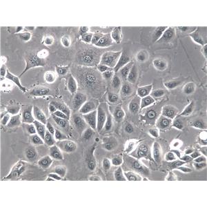COLO 206F Cells|人结肠癌克隆细胞