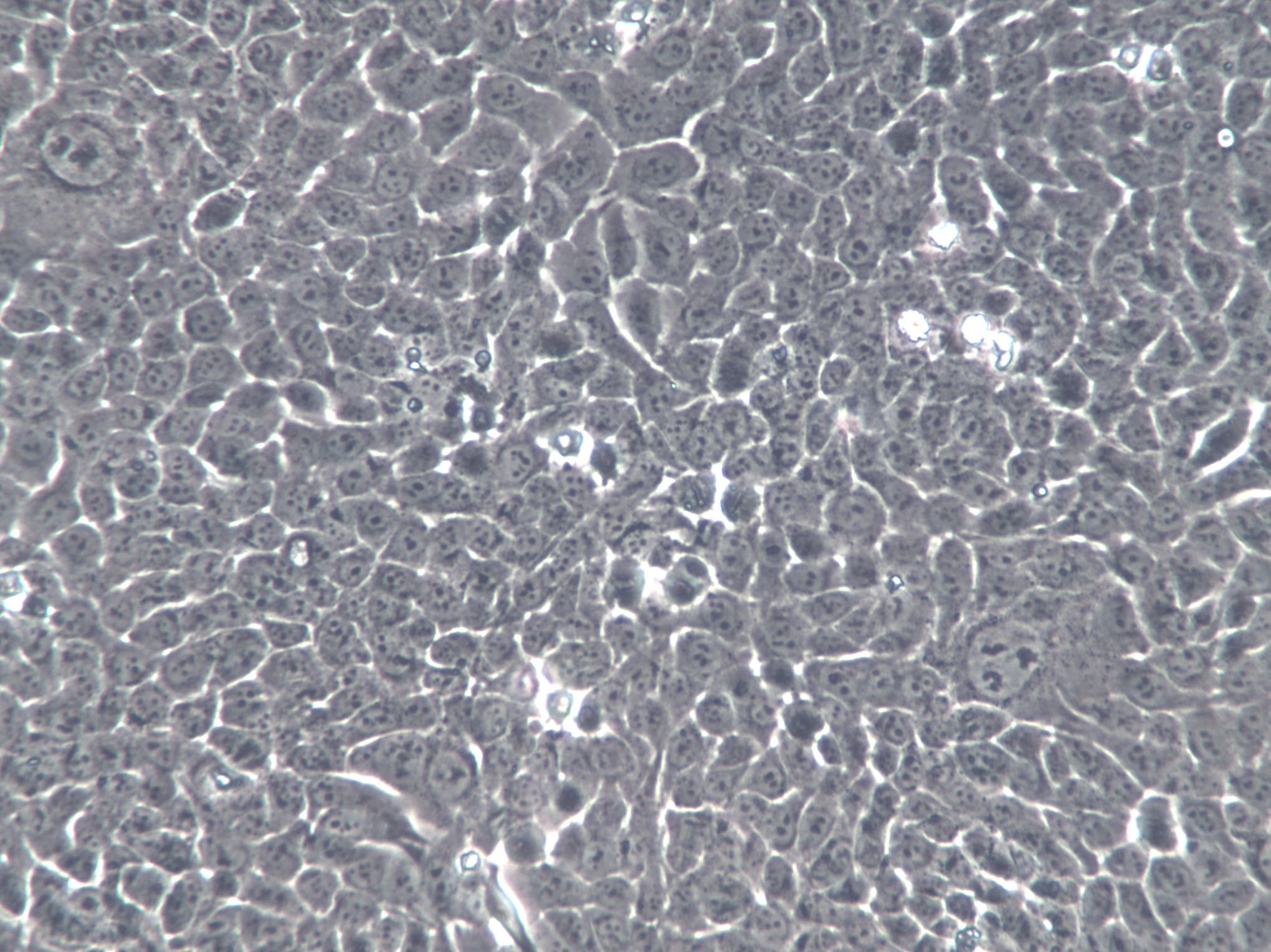 SV-HUC-1 Cells(赠送Str鉴定报告)|人膀胱上皮永生化细胞,SV-HUC-1 Cells