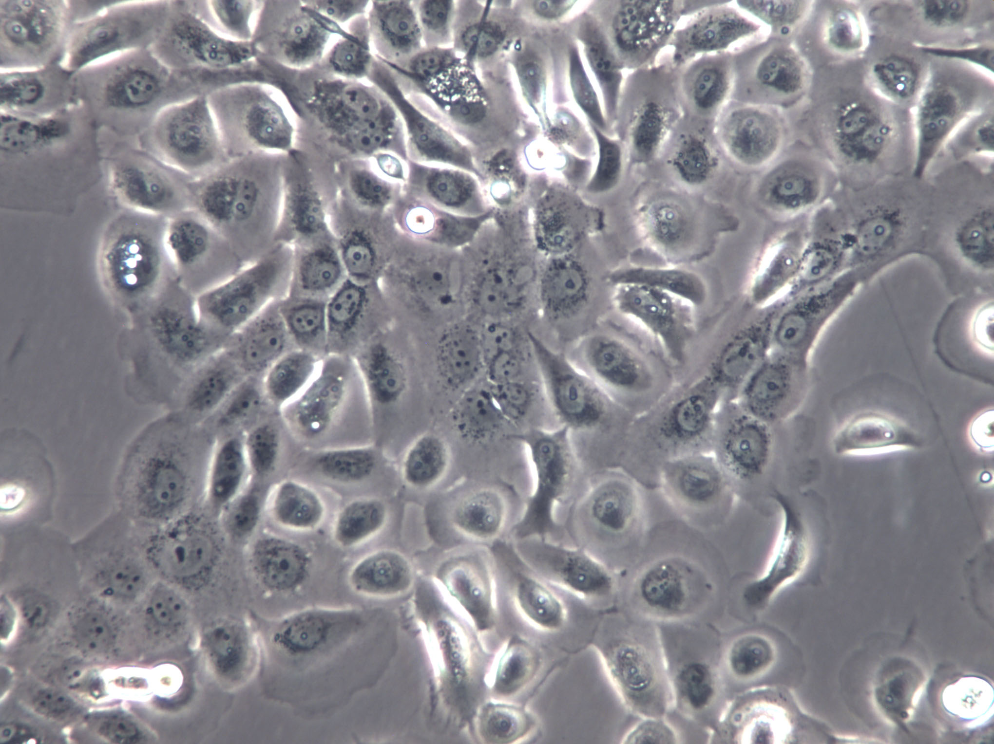ID8 Cells(赠送Str鉴定报告)|小鼠卵巢癌细胞,ID8 Cells