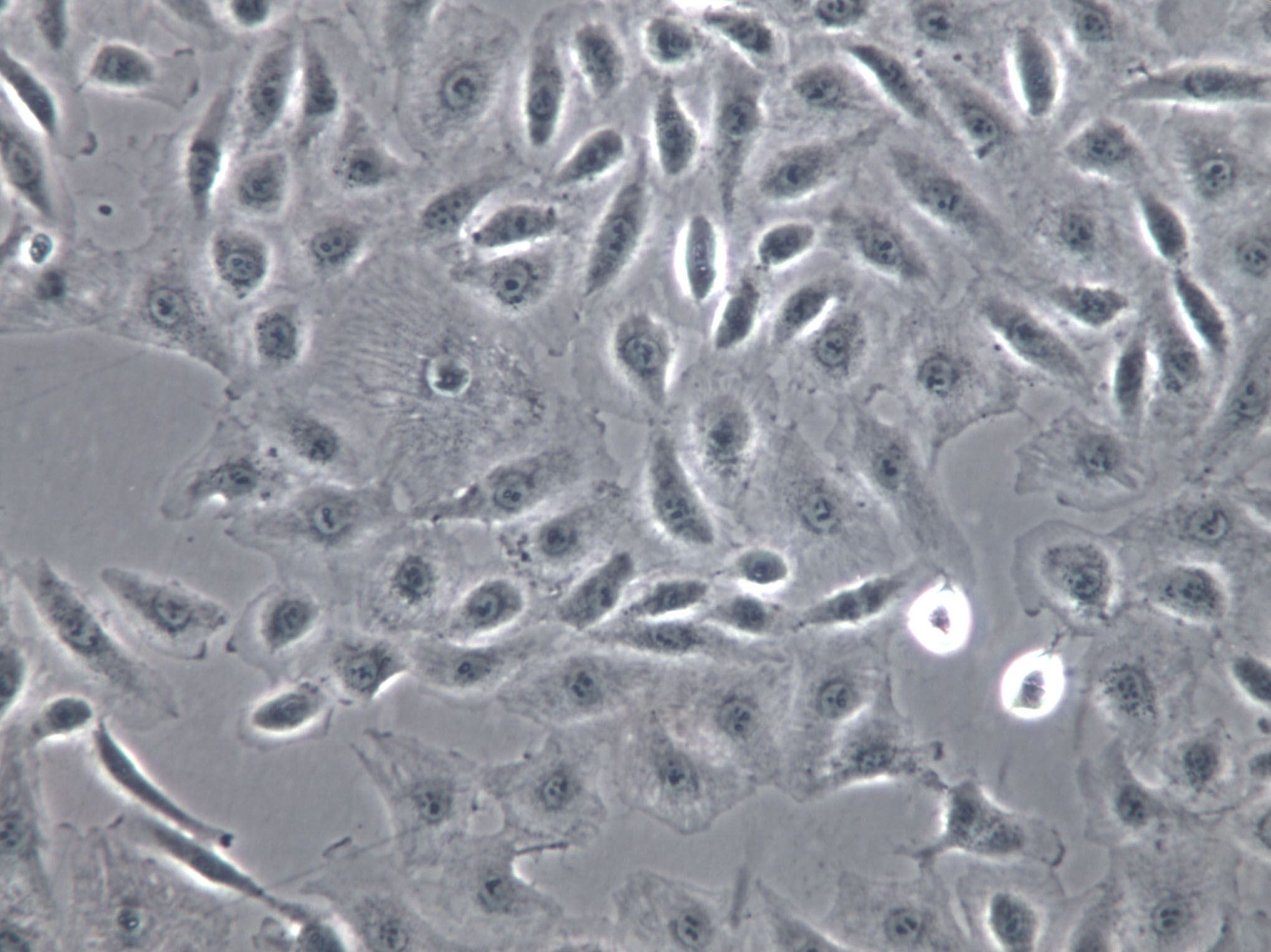 SNU-601 Cells|人胃癌克隆细胞,SNU-601 Cells