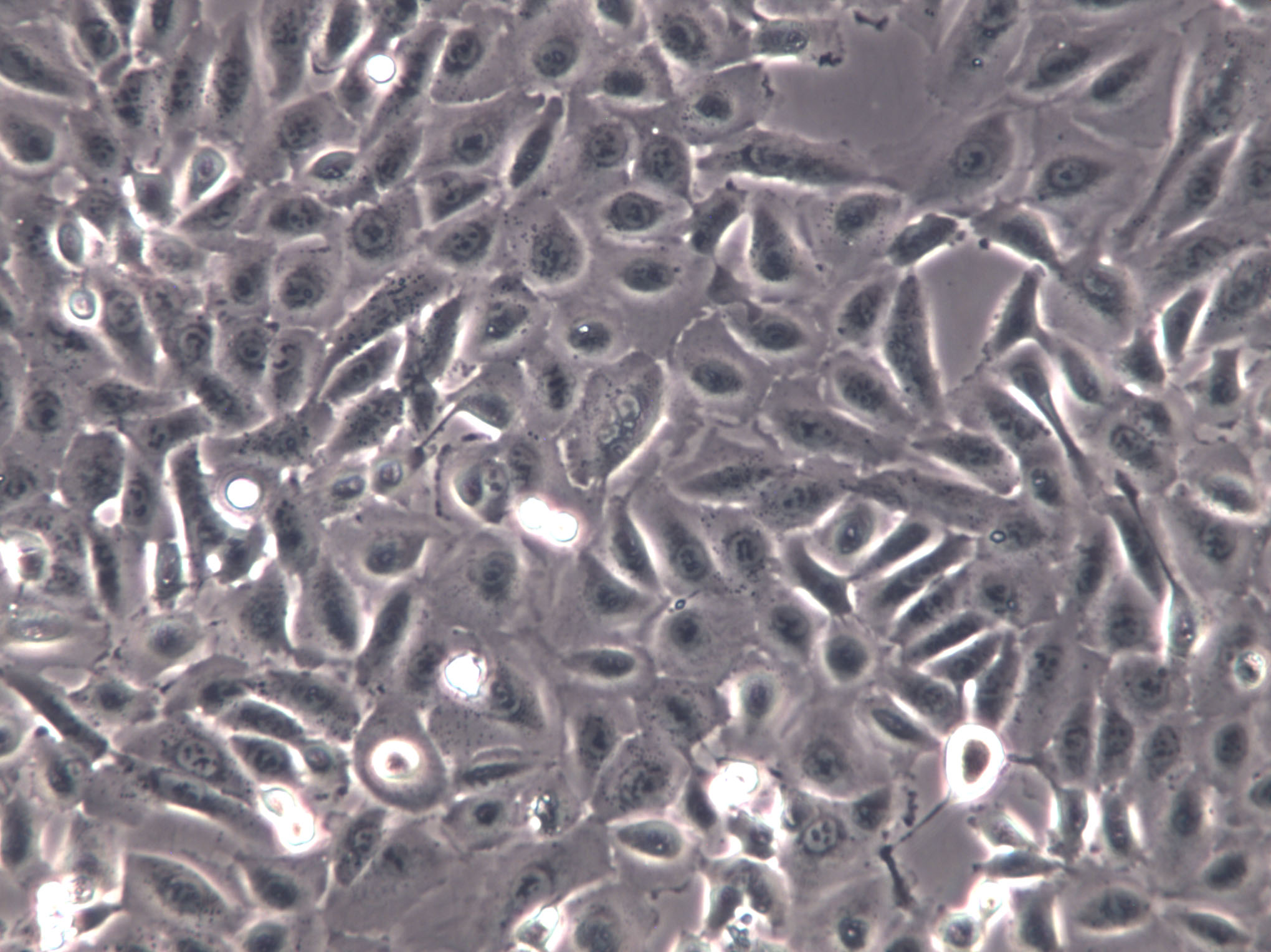 HCC1171 Cells|人肺癌腺癌克隆细胞,HCC1171 Cells