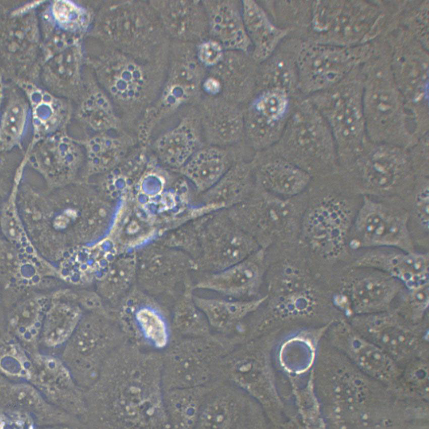 HCC1833 Cells|人肺癌腺癌克隆细胞,HCC1833 Cells