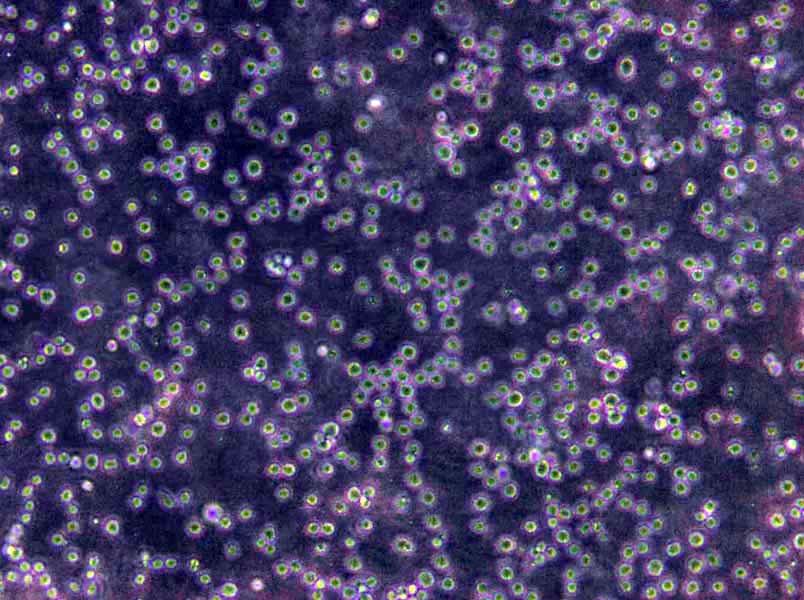 RA-FLSs Cells|類(lèi)風(fēng)濕關(guān)節(jié)炎成纖維樣滑膜克隆細(xì)胞,RA-FLSs Cells