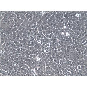 SV-HUC-1 Cells(赠送Str鉴定报告)|人膀胱上皮永生化细胞