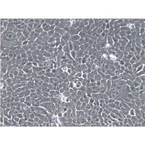 SV-HUC-1 Cells(赠送Str鉴定报告)|人膀胱上皮永生化细胞,SV-HUC-1 Cells