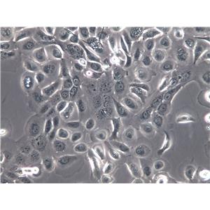 ID8 Cells(赠送Str鉴定报告)|小鼠卵巢癌细胞