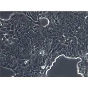 SW756 Cells|人子宫鳞状癌克隆细胞