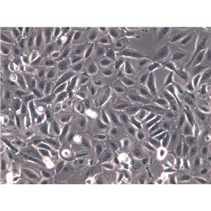 HCC1171 Cells|人肺癌腺癌克隆细胞,HCC1171 Cells