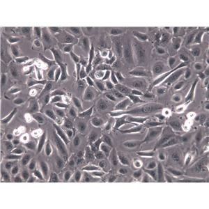 NCI-H2198 Cells|人肺癌克隆细胞,NCI-H2198 Cells