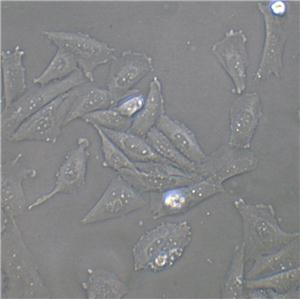 SK-LMS-1 Cells|人阴户平滑肌肉瘤克隆细胞