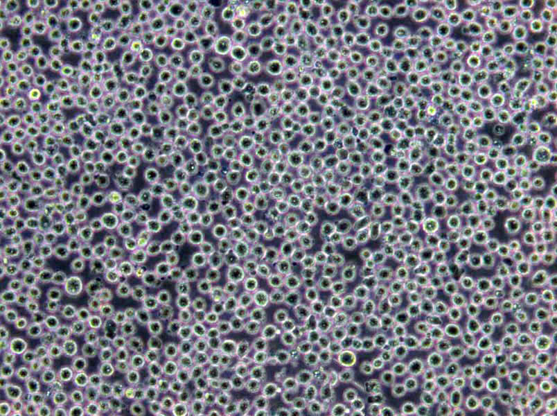 HCC78 Cells(赠送Str鉴定报告)|人肺腺癌细胞,HCC78 Cells