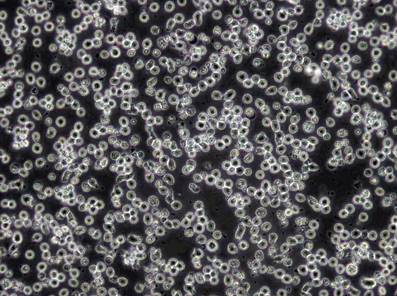 CCD-19Lu Cells|人肺成纖維克隆細胞,CCD-19Lu Cells