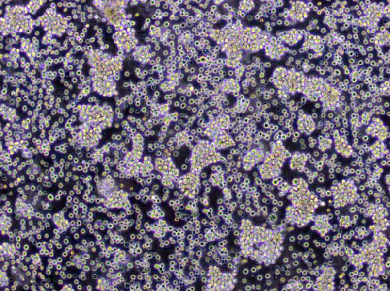 Daudi Cells|人Burkkit淋巴瘤克隆细胞,Daudi Cells