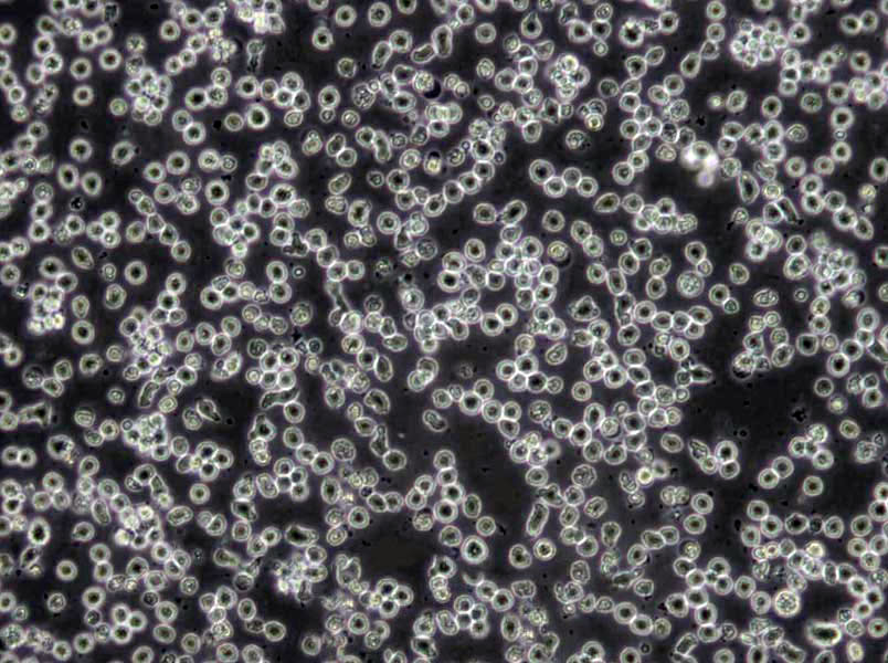 Loucy Cells|人淋巴细胞白血病克隆细胞,Loucy Cells