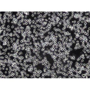 CCD-19Lu Cells|人肺成纤维克隆细胞,CCD-19Lu Cells