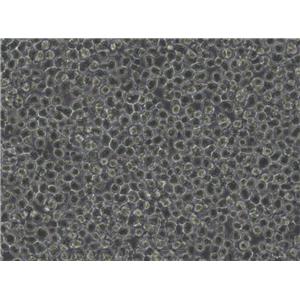 RPMI-8226 Cells|人多发性骨髓瘤克隆细胞