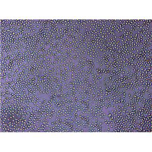 U266B1 Cells|人外周淋巴克隆细胞,U266B1 Cells