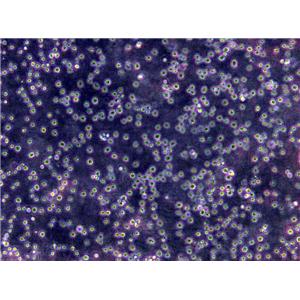 TALL-1 [Human adult T-ALL] Cells|急性T淋巴细胞白血病克隆细胞