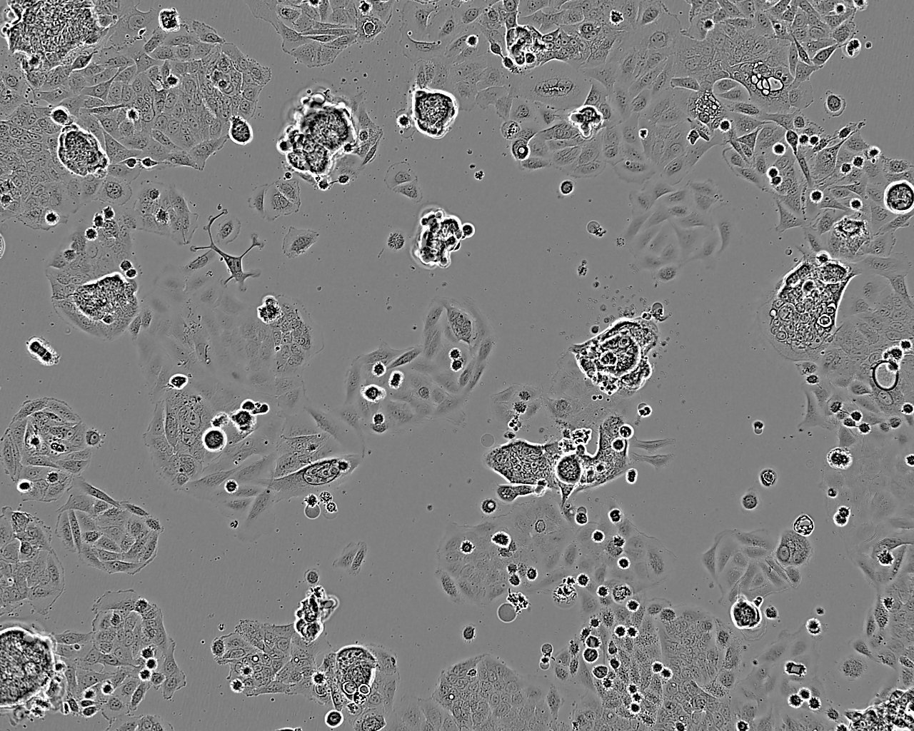 A-431 Cells|人皮肤鳞癌可传代细胞系,A-431 Cells