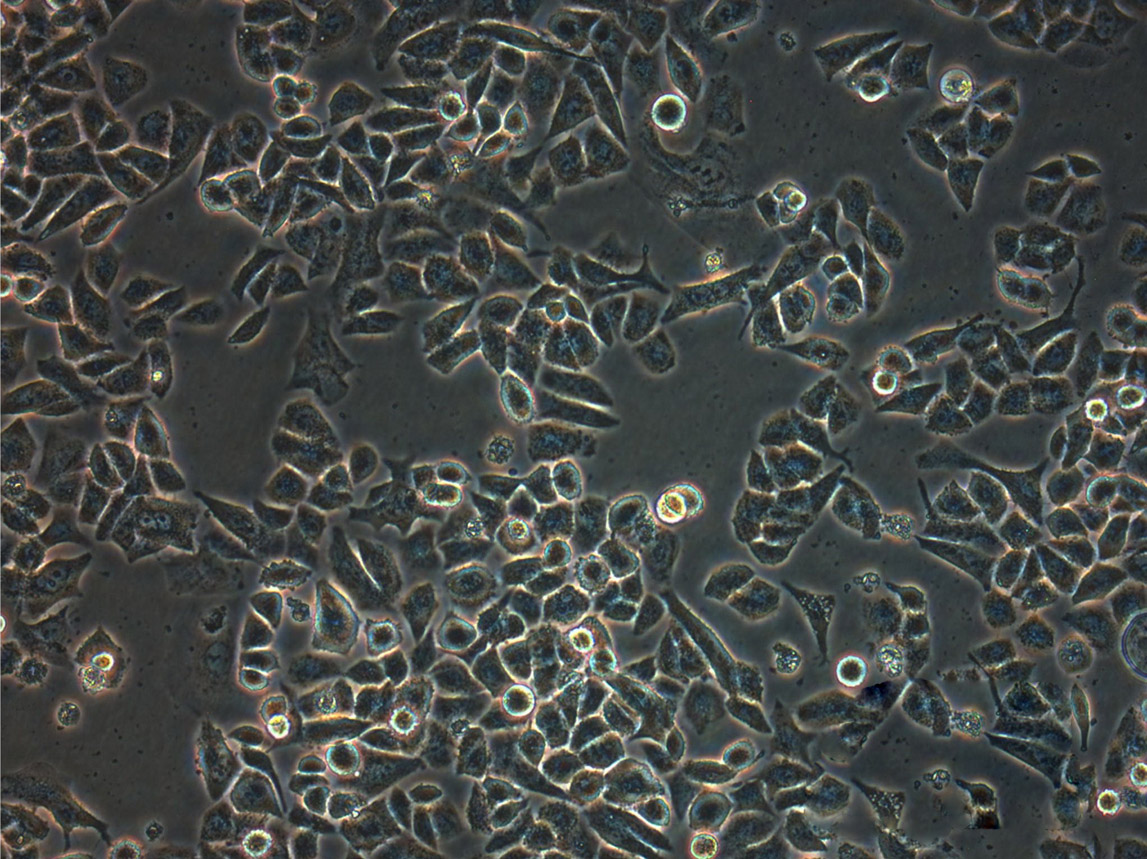 TE-8 Cells(赠送Str鉴定报告)|人食管癌细胞,TE-8 Cells
