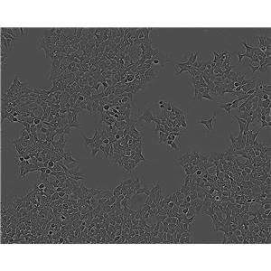 NCI-H1299 Cells(赠送Str鉴定报告)|人非小细胞肺癌细胞