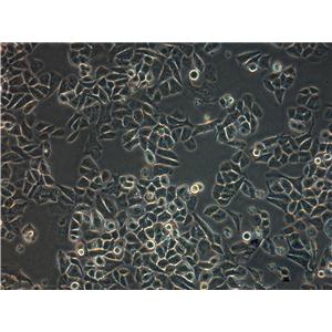 MDA-MB-330 Cells|人浸润性小叶性乳腺癌可传代细胞系