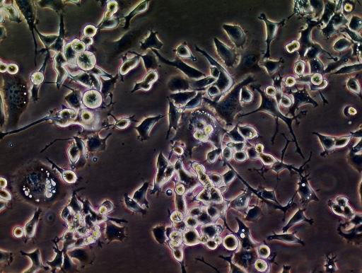 PIG1 Cells|正常人皮肤黑色素可传代细胞系,PIG1 Cells