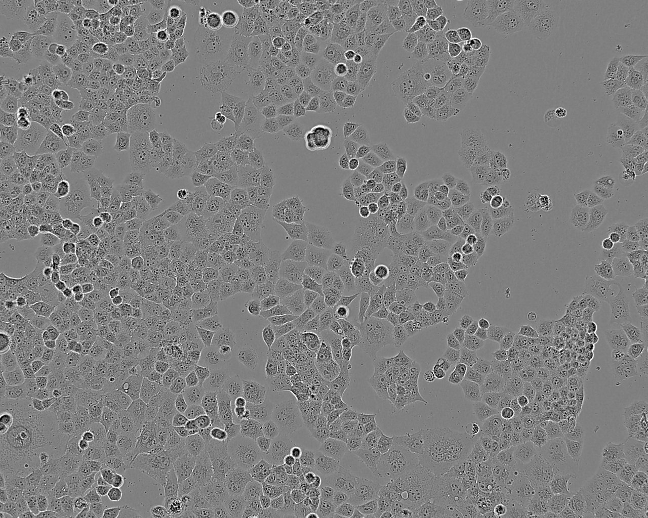 Hs 695T Cells(赠送Str鉴定报告)|人黑色素瘤细胞,Hs 695T Cells