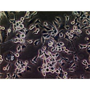 HEK293-F Cells(赠送Str鉴定报告)|人胚肾细胞,HEK293-F Cells
