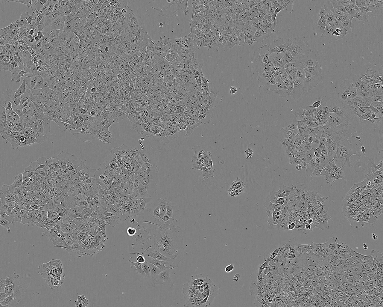 SK-MEL-28 Cells(赠送Str鉴定报告)|人恶性黑色素瘤细胞,SK-MEL-28 Cells