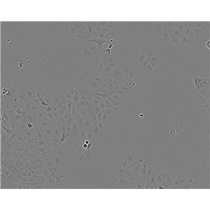 Capan-2 Cells(赠送Str鉴定报告)|人胰腺癌细胞